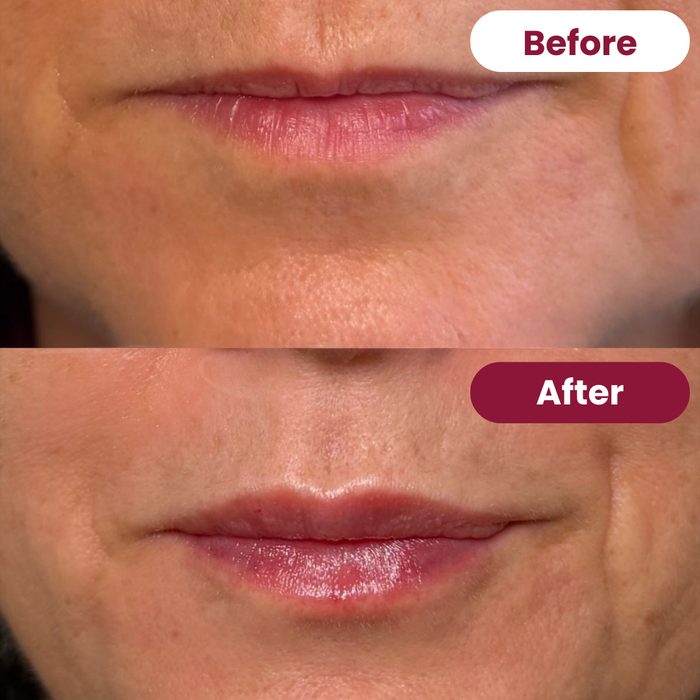 The Overnight Glow Set